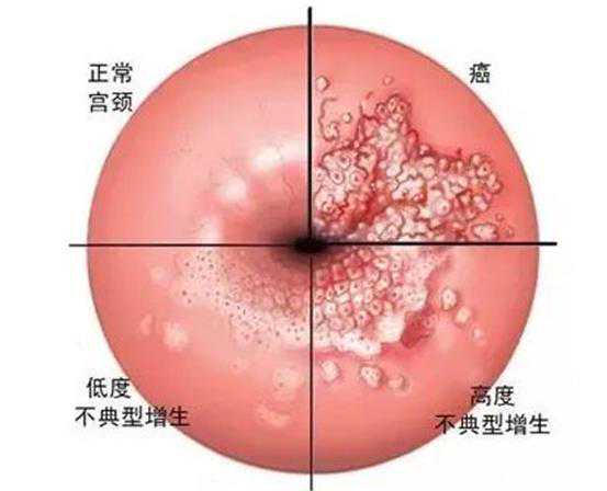 厦门代孕人工受精_安庆有能做供卵试管的机构吗？